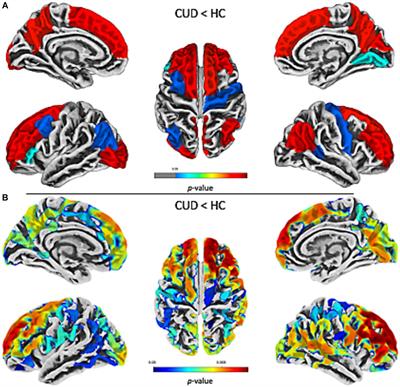 Lower cortical thickness and increased brain aging in adults with cocaine use disorder